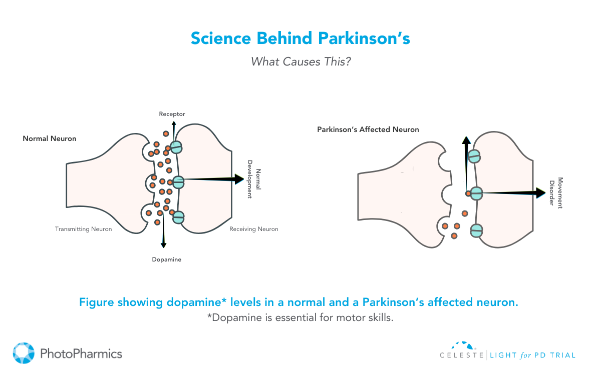 Science Behind Parkinson's